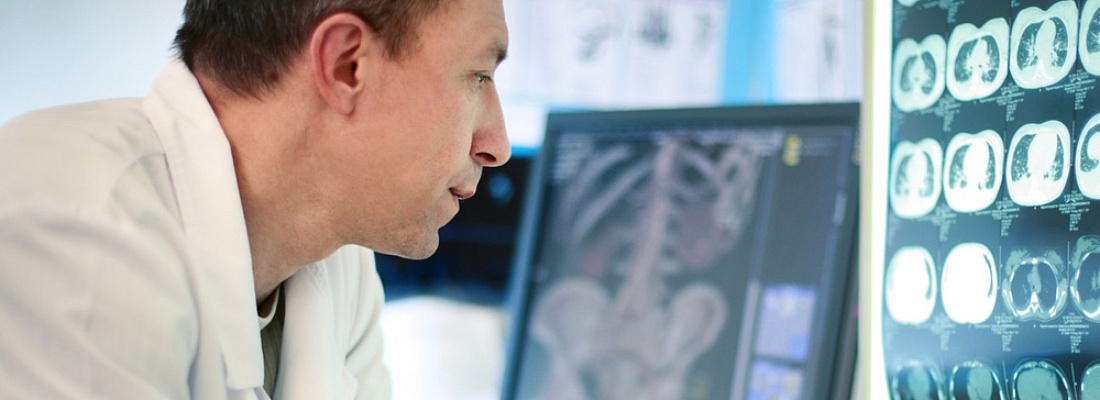 radiologist viewing xrays