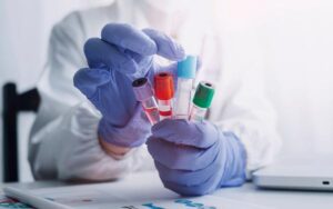 Stock photo of Laboratory worker holding blood vials