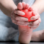 Image of an Inflammed Foot